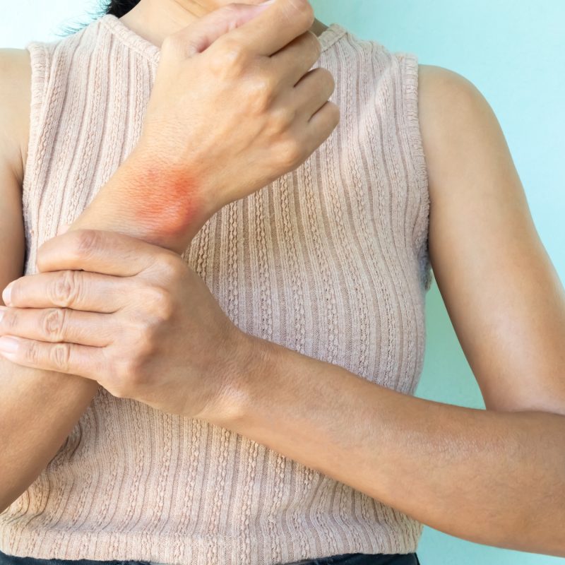 Wrist pain, woman injury hannd